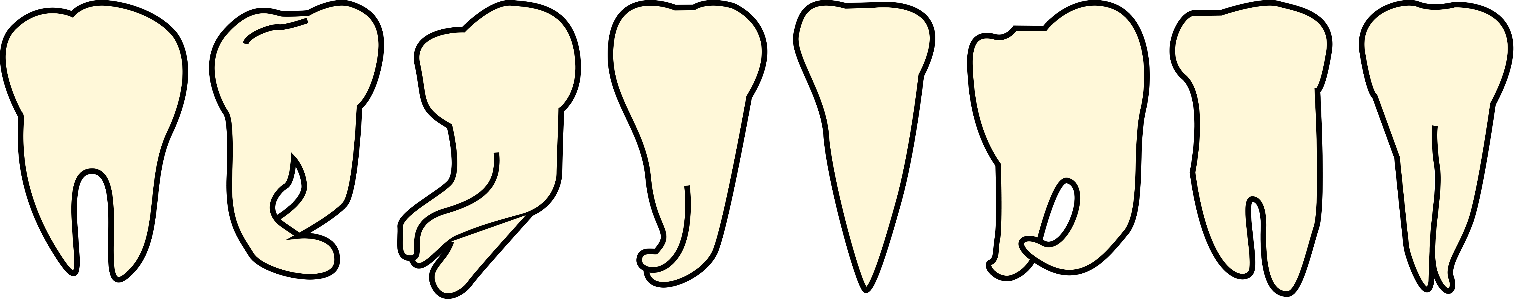 sc-plus inherent anatomy of the root canal